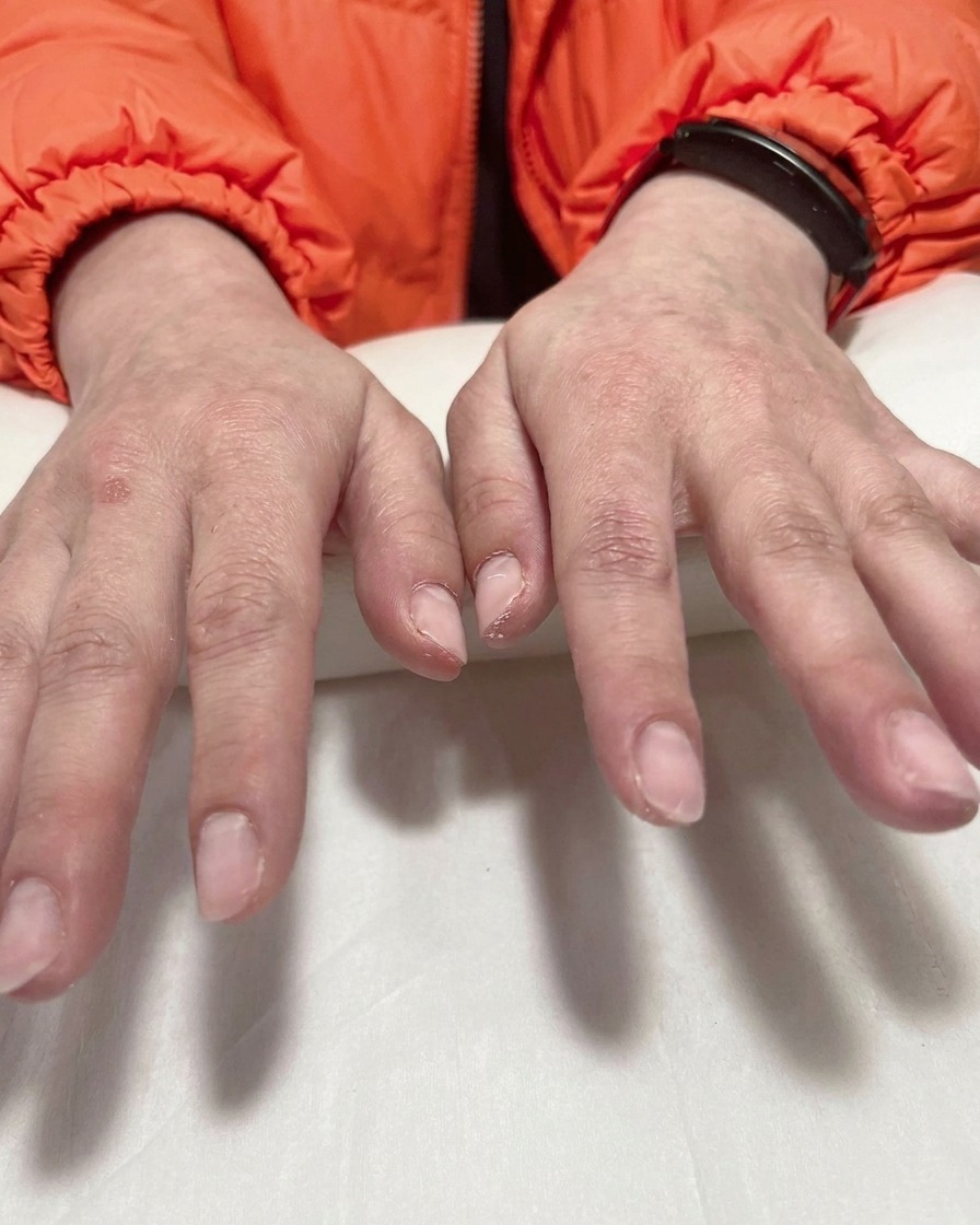 Nahaufnahme einer Hand, die mit einer Pinzette vorsichtig eine violette Schablone vom Nagel abzieht, wodurch eine scharfe weiße Ombré-Spitze sichtbar wird.