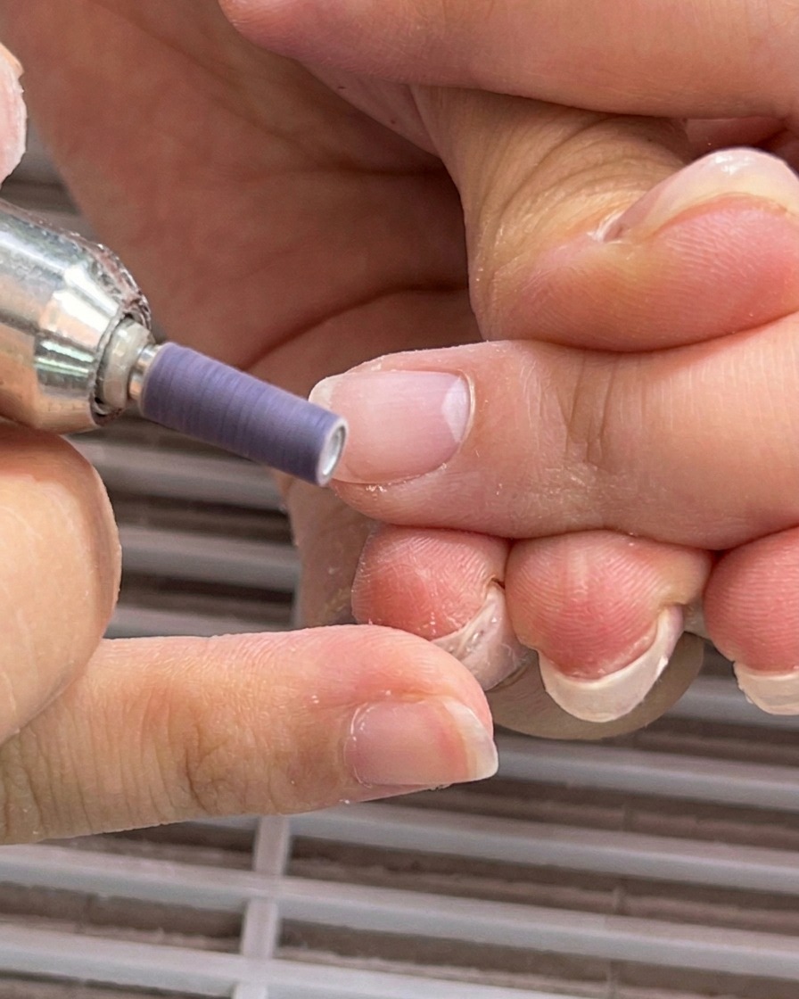 Ein elektrischer Fräser mit einem Schleifband glättet den Nagelbereich nahe dem Nagelhautwall.