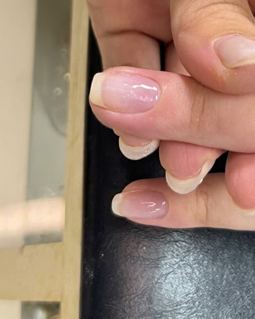 Eine kleine Kugel Aufbaugel in der Mitte der Nagelplatte, bereit zum Modellieren.
