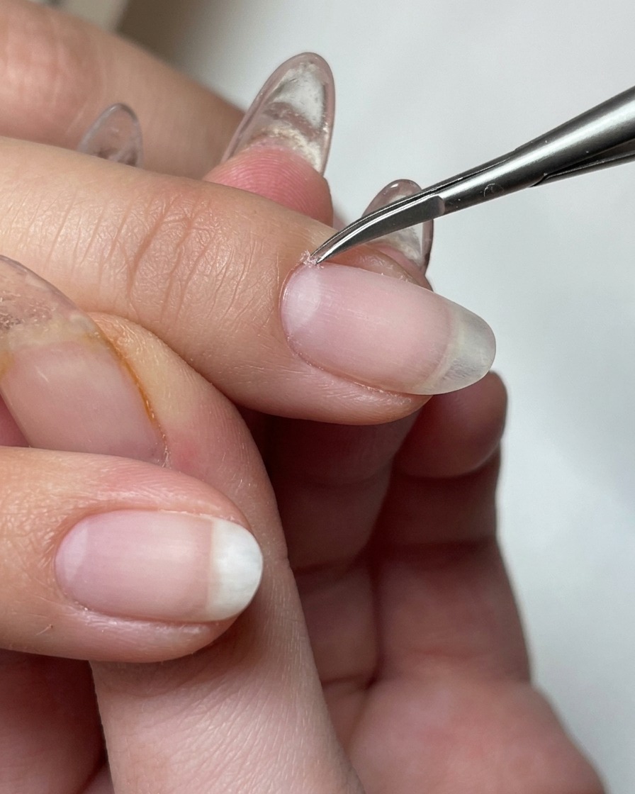 Nahaufnahme eines elektrischen Fräser-Aufsatzes, der abgestorbene Haut im Nagelhautbereich entfernt.