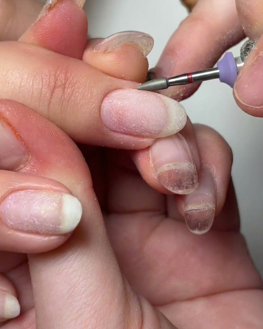 Ein kegelförmiger Fräser-Bit reinigt den Nagelhautbereich mit Alkohol.