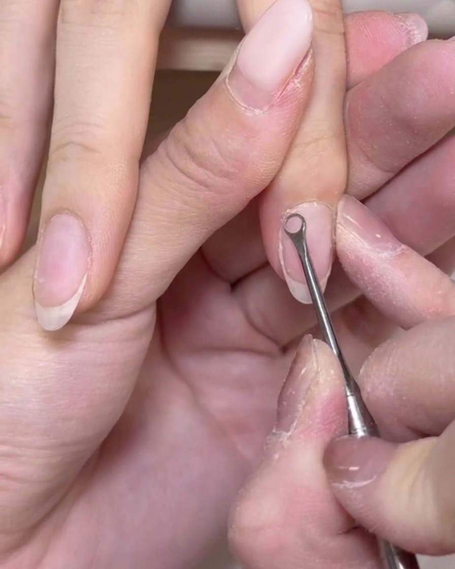 Ein Metallwerkzeug schabt vorsichtig abgestorbene Hautzellen von der Oberfläche eines Naturnagels ab.