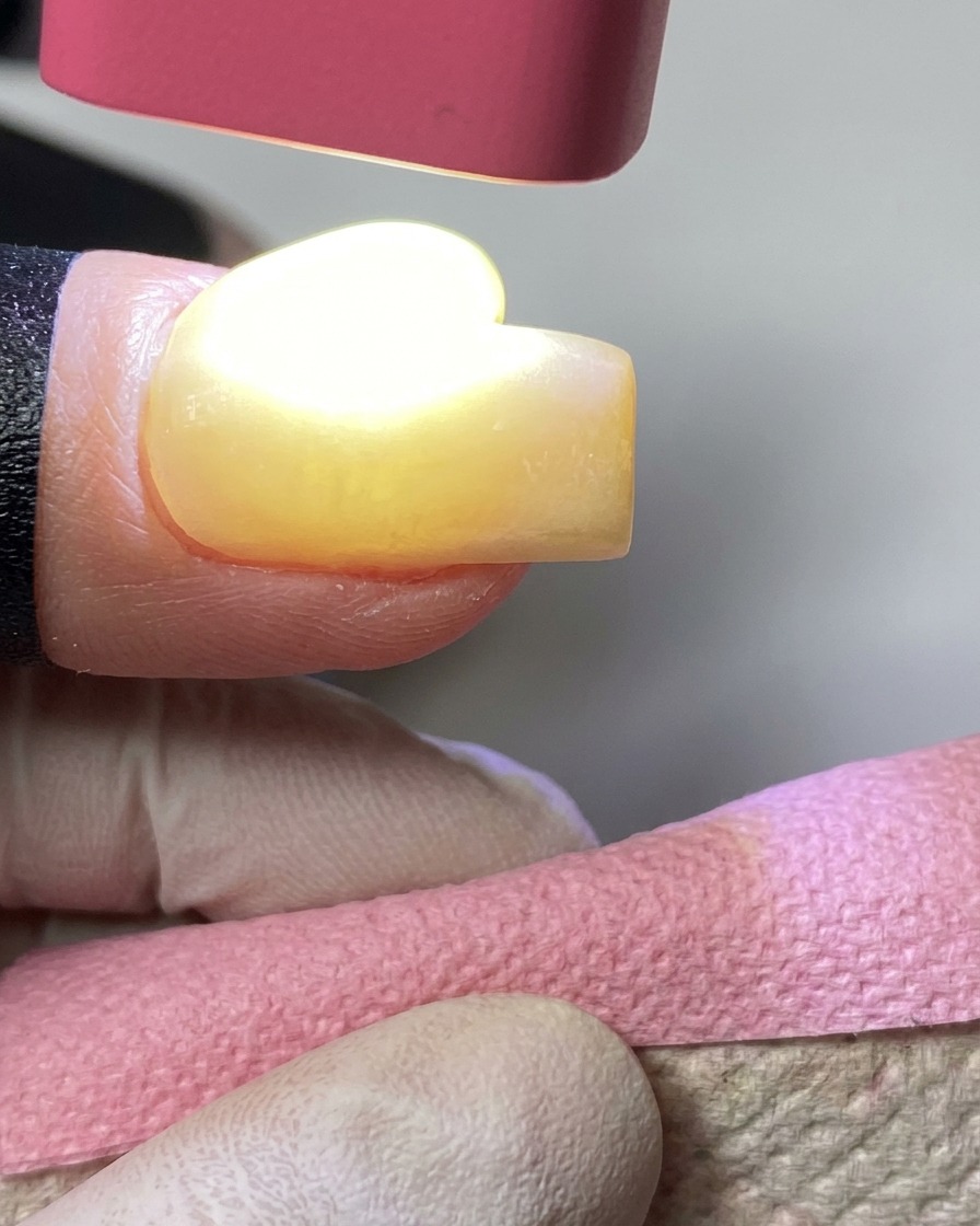 Eine pinke Hand-UV-Lampe härtet gelben Gelack auf einem Fingernagel aus.