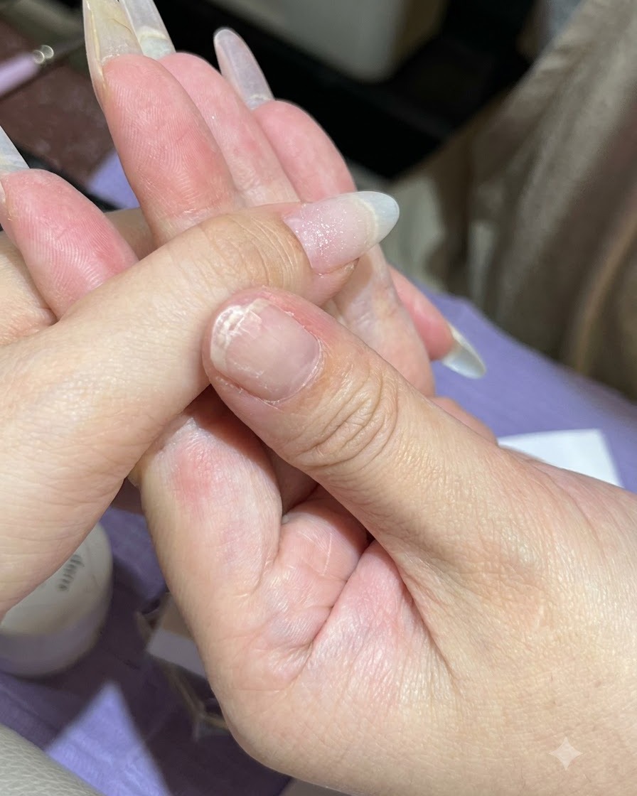 Ein Schwamm tupft mintgrünes Gel auf die Spitze eines Daumennagels.