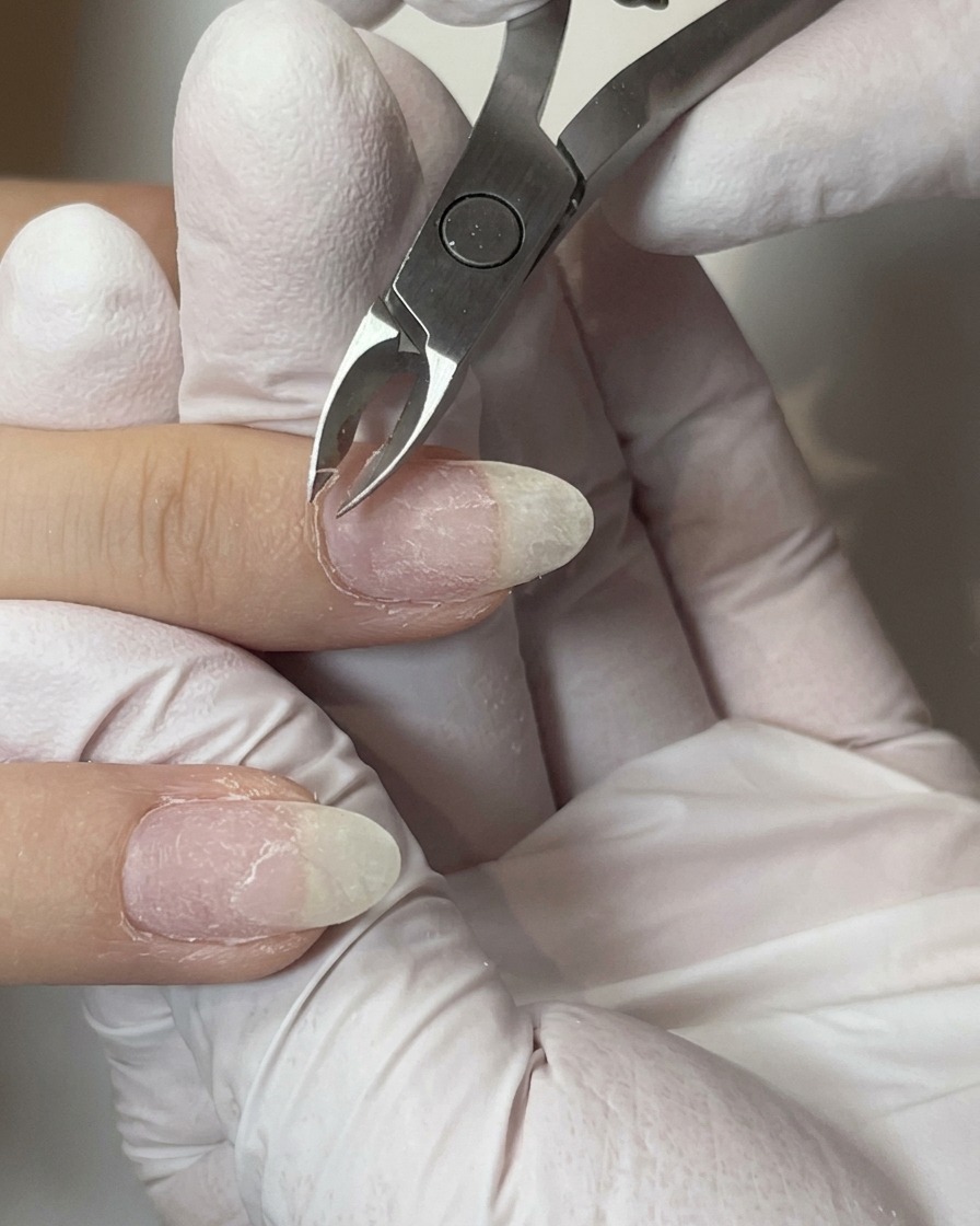Eine Hautzange aus Metall schneidet vorsichtig überschüssige Haut um die Nagelfalz eines vorbereiteten Fingers ab.