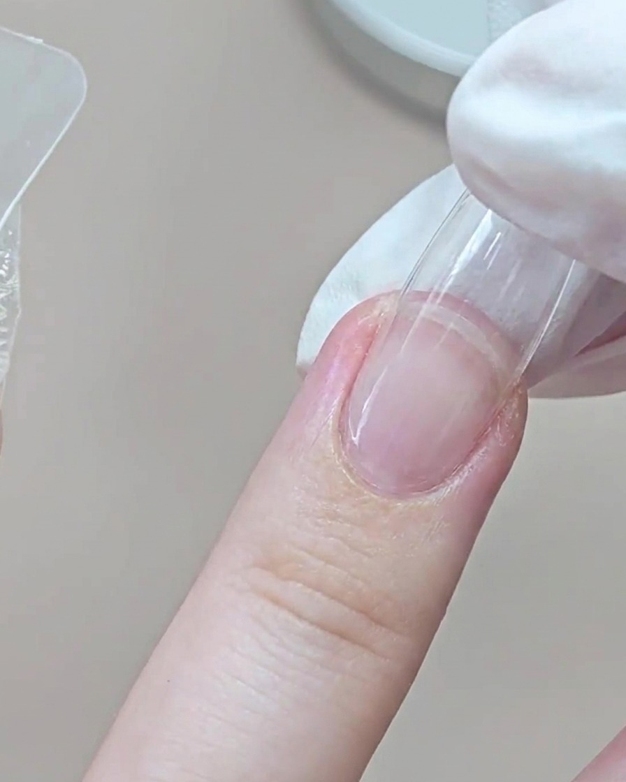 Ein behandschuhter Finger drückt eine transparente Dual Form in der Nähe der Nagelhaut auf den Ringfinger.